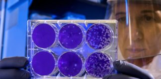 Zapalenie płuc Legionella