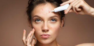 Jak walczyć z trądzikiem różowatym