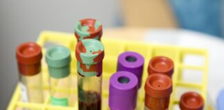 anemia z niedoboru żelaza