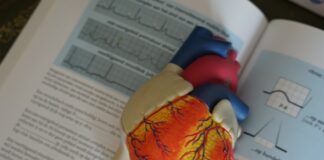 choroby układu krążenia