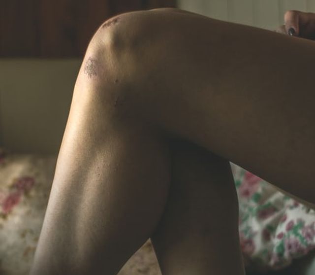 zwyrodnienie stawów