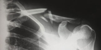 W trosce o swoje zdrowie warto wykonać rezonans magnetyczny