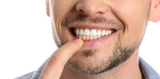 co może uszkadzać błonę śluzową jamy ustnej