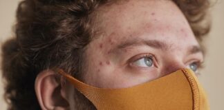 Trądzik torbielowaty