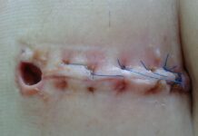 Co może doprowadzić do obumarcia płodu? Co może doprowadzić do obumarcia płodu?