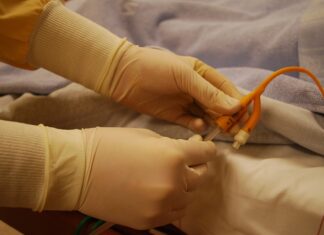 Dlaczego zatyka się cewnik?