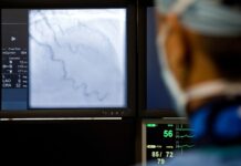 Choroba wieńcowa: Przyczyny, objawy i diagnostyka Skurcz tętnicy wieńcowej a objawy choroby wieńcowej - obraz przedstawiający zablokowane naczynia krwionośne